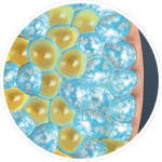 Fat Freezing by CoolSculpting