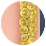 Fat Freezing How CoolSculpting Works